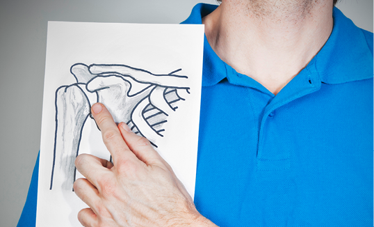 Zu sehen ist die Schulter eines Mannes in blauem Poloshirt, der ein Blatt Papier vor die Schulter hält, auf den ein Schultergelenk eingezeichnet ist.